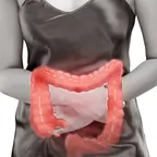 Intestino inflamado
